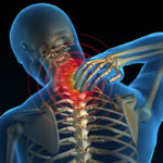 treating neck pain